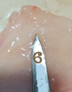 Toxiinfecciones alimentarias: anisakiasis (I)